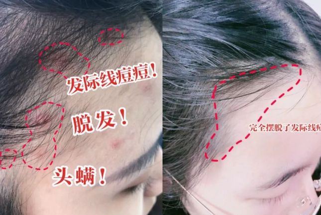 10分钟轻松养成女明星「绸缎发」新葡京洗完头自然风干还是吹干好？(图18)